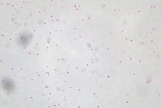 Akkermansia Muciniphila AKK016 AKK از سفید تا خاکستری روشن پودر/ پروبیوتیک